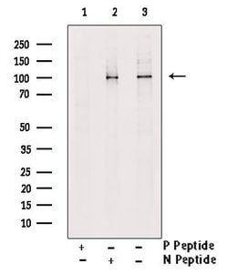 Invitrogen Phospho-SEMA4B (Ser825) Polyclonal Antibody 100 &mu;L | Buy Online | Invitrogen&trade; | Fisher Scientific