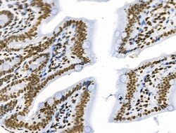 Invitrogen Phospho-SF3B1 (Thr313) Polyclonal Antibody 100 &mu;L; Unconjugated:Antibodies,