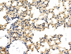 Invitrogen Phospho-SHIP2 (Tyr1135) Polyclonal Antibody 100 &mu;L; Unconjugated:Antibodies,