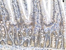 Invitrogen Phospho-SHIP2 (Tyr1135) Polyclonal Antibody 100 &mu;L; Unconjugated:Antibodies,