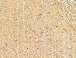 Invitrogen Phospho-SHIP2 (Tyr1135) Polyclonal Antibody 100 &mu;L; Unconjugated:Antibodies,