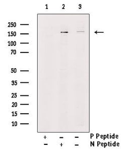 Phospho-SHIP2 (Tyr986, Tyr987) Polyclonal Antibody, Invitrogen 100 &mu;L;
