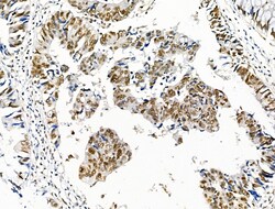 Invitrogen Phospho-SKP2 (Ser64) Polyclonal Antibody 100 &mu;L; Unconjugated:Antibodies,