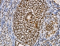 Invitrogen Phospho-SKP2 (Ser64) Polyclonal Antibody 100 &mu;L; Unconjugated:Antibodies,