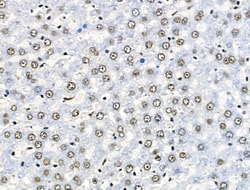 Invitrogen Phospho-SKP2 (Ser64) Polyclonal Antibody 100 &mu;L; Unconjugated:Antibodies,