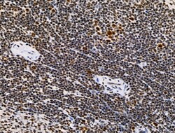 Invitrogen Phospho-SKP2 (Ser64) Polyclonal Antibody 100 &mu;L; Unconjugated:Antibodies,