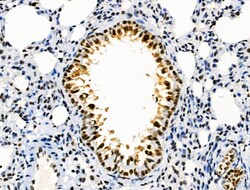 Invitrogen Phospho-SKP2 (Ser64) Polyclonal Antibody 100 &mu;L; Unconjugated:Antibodies,