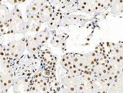 Invitrogen Phospho-SKP2 (Ser64) Polyclonal Antibody 100 &mu;L; Unconjugated:Antibodies,
