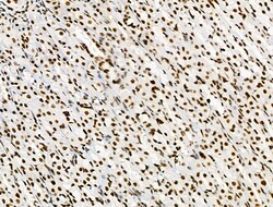 Invitrogen Phospho-SKP2 (Ser64) Polyclonal Antibody 100 &mu;L; Unconjugated:Antibodies,