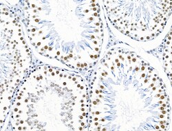Invitrogen Phospho-SKP2 (Ser64) Polyclonal Antibody 100 &mu;L; Unconjugated:Antibodies,