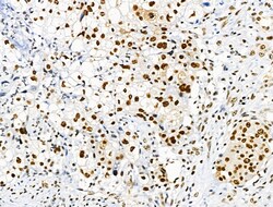 Invitrogen Phospho-SKP2 (Ser64) Polyclonal Antibody 100 &mu;L; Unconjugated:Antibodies,