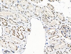 Invitrogen Phospho-SKP2 (Ser64) Polyclonal Antibody 100 &mu;L; Unconjugated:Antibodies,