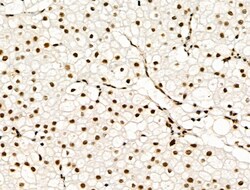 Invitrogen Phospho-SKP2 (Ser64) Polyclonal Antibody 100 &mu;L; Unconjugated:Antibodies,