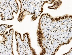 Invitrogen Phospho-SKP2 (Ser64) Polyclonal Antibody 100 &mu;L; Unconjugated:Antibodies,
