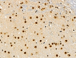 Invitrogen Phospho-SKP2 (Ser64) Polyclonal Antibody 100 &mu;L; Unconjugated:Antibodies,