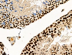 Invitrogen Phospho-SKP2 (Ser64) Polyclonal Antibody 100 &mu;L; Unconjugated:Antibodies,