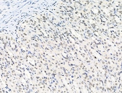 Invitrogen Phospho-SQSTM1 (Ser349) Polyclonal Antibody 100 &mu;L | Buy Online | Invitrogen&trade; | Fisher Scientific