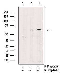 Phospho-SQSTM1 (Thr269, Ser272) Polyclonal Antibody, Invitrogen 100 &mu;L | Buy Online | Thermo Scientific | Fisher Scientific