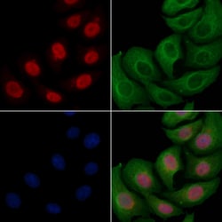 Invitrogen Phospho-SRC3 (Thr24) Polyclonal Antibody 100 &mu;L; Unconjugated:Antibodies,