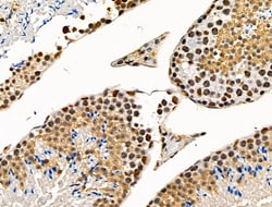 Invitrogen Phospho-SRC3 (Thr24) Polyclonal Antibody 100 &mu;L; Unconjugated:Antibodies,