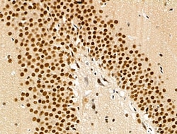 Invitrogen Phospho-SRC3 (Thr24) Polyclonal Antibody 100 &mu;L; Unconjugated:Antibodies,