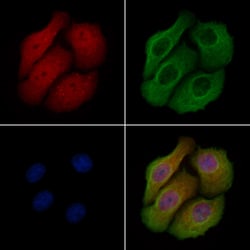 Invitrogen Phospho-SSH3 (Ser37) Polyclonal Antibody 100 &mu;L; Unconjugated:Antibodies,