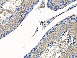 Invitrogen Phospho-SSH3 (Ser37) Polyclonal Antibody 100 &mu;L; Unconjugated:Antibodies,
