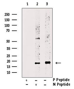 Invitrogen Phospho-Survivin (Thr34) Polyclonal Antibody 100 &mu;L | Buy Online | Invitrogen&trade; | Fisher Scientific