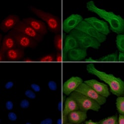 Invitrogen Phospho-Survivin (Thr34) Polyclonal Antibody 100 &mu;L | Buy Online | Invitrogen&trade; | Fisher Scientific