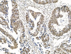 Invitrogen Phospho-Survivin (Thr34) Polyclonal Antibody 100 &mu;L | Buy Online | Invitrogen&trade; | Fisher Scientific