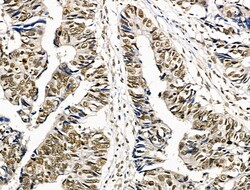 Invitrogen Phospho-Survivin (Thr34) Polyclonal Antibody 100 &mu;L | Buy Online | Invitrogen&trade; | Fisher Scientific