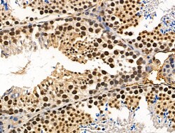 Invitrogen Phospho-Survivin (Thr34) Polyclonal Antibody 100 &mu;L | Buy Online | Invitrogen&trade; | Fisher Scientific