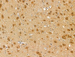 Invitrogen Phospho-Survivin (Thr34) Polyclonal Antibody 100 &mu;L | Buy Online | Invitrogen&trade; | Fisher Scientific