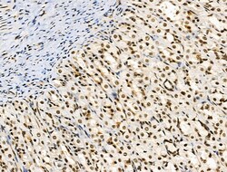 Invitrogen Phospho-Survivin (Thr34) Polyclonal Antibody 100 &mu;L | Buy Online | Invitrogen&trade; | Fisher Scientific