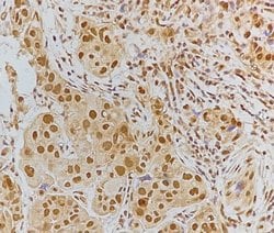 Invitrogen Phospho-Tau (Ser519) Polyclonal Antibody 100 &mu;L; Unconjugated:Antibodies,