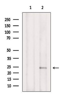 Invitrogen Phospho-TPT1 (Ser46) Polyclonal Antibody 100 &mu;L | Buy Online | Invitrogen&trade; | Fisher Scientific
