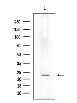 Invitrogen Phospho-TPT1 (Ser46) Polyclonal Antibody 100 &mu;L | Buy Online | Invitrogen&trade; | Fisher Scientific