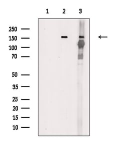Invitrogen Phospho-TEK (Tyr992) Polyclonal Antibody 100 &mu;L | Buy Online | Invitrogen&trade; | Fisher Scientific