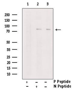 Invitrogen Phospho-TNK1 (Tyr277) Polyclonal Antibody 100 &mu;L | Buy Online | Invitrogen&trade; | Fisher Scientific