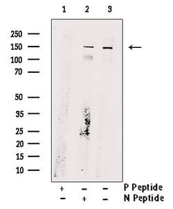 Invitrogen Phospho-ULK1 (Ser467) Polyclonal Antibody 100 &mu;L; Unconjugated:Antibodies,