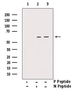Invitrogen Phospho-Vimentin (Ser83) Polyclonal Antibody 100 &mu;L; Unconjugated:Antibodies,