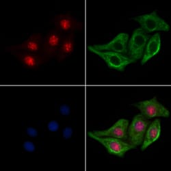 Invitrogen Phospho-CDK6 (Tyr24) Polyclonal Antibody 100 &mu;L; Unconjugated:Antibodies,