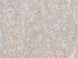 Invitrogen Phospho-IkappaB epsilon (Ser161) Polyclonal Antibody 100 &mu;L;