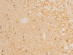 Invitrogen Phospho-IkappaB epsilon (Ser161) Polyclonal Antibody 100 &mu;L;
