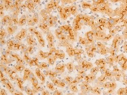 Invitrogen Phospho-IkappaB epsilon (Ser161) Polyclonal Antibody 100 &mu;L;