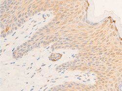 Invitrogen Phospho-IkappaB epsilon (Ser161) Polyclonal Antibody 100 &mu;L;