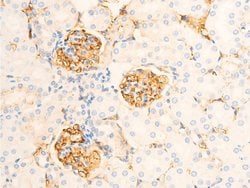 Invitrogen Phospho-IkappaB epsilon (Ser161) Polyclonal Antibody 100 &mu;L;