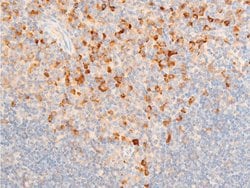 Invitrogen Phospho-IkappaB epsilon (Ser161) Polyclonal Antibody 100 &mu;L;