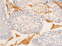 Invitrogen Phospho-IkappaB epsilon (Ser161) Polyclonal Antibody 100 &mu;L;