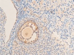 Invitrogen Phospho-IkappaB epsilon (Ser161) Polyclonal Antibody 100 &mu;L;